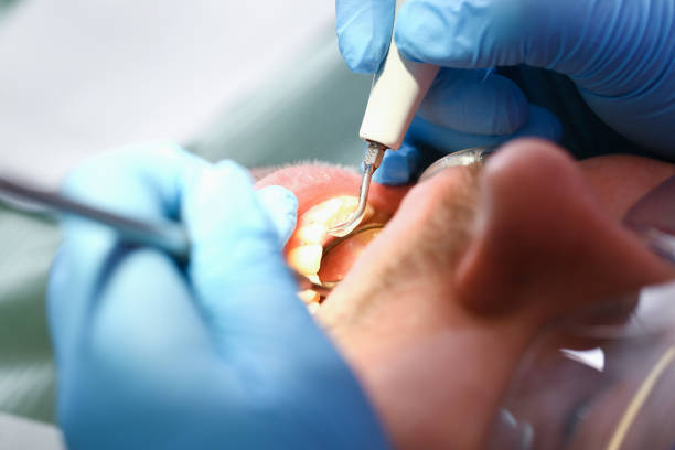 Best Same-Day Emergency Dental Services in Marillo, CA