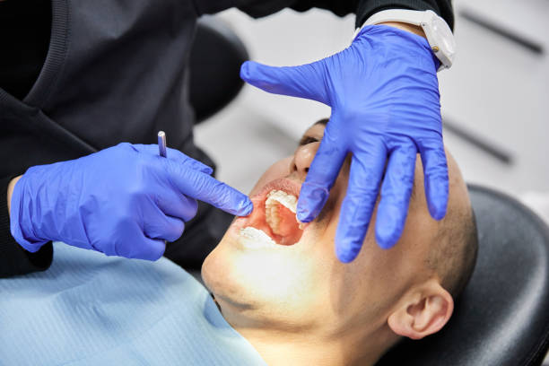 Best Emergency Gum Treatment in Marillo, CA