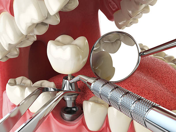 Best Cosmetic Emergency Dentistry in Marillo, CA